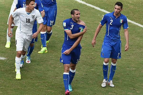 Italy’s defender Giorgio Chiellini shows off a bite mark on his shoulder. Yasuyoshi Chiba—AFP