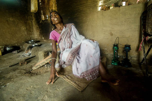 A 72-year-old woman accused of witchcraft had her ankles broken to prevent her from working in the fields. Sindhuja Parthasarathy—AFP